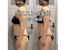 マテリアル 痩身骨気サロン(MATERIAL)