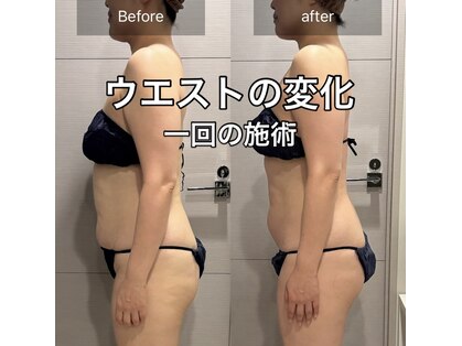 マテリアル 痩身骨気サロン(MATERIAL)の写真
