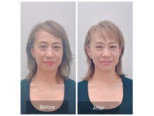 アンジェリカの雰囲気（耳介筋膜剥リリース一度でフェイスライン激変＆リンパもスッキリ）
