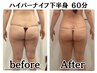 ハイパーナイフ下半身 60分【むくみスッキリ×美脚&美尻】¥12000→7500