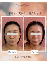 すなお 溝の口(Sunao)/【小顔コルギリンパ】40代お客様
