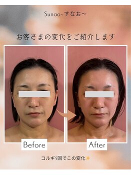 すなお 溝の口(Sunao)/【小顔コルギリンパ】40代お客様