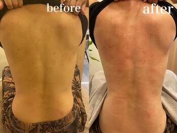 エンソワー(en'sower)/温活でむくみとり♪肌で飲む漢方