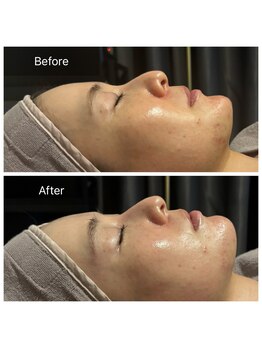 エヌア(nA)/クリスティーナ【アンストレス】