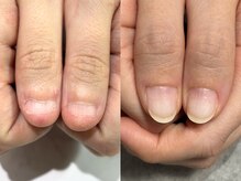 アリエ(allie)/隠し続ける？悩み続ける？