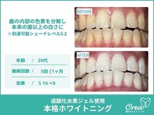 クレア(Crea)/【ホワイトニング症例写真】