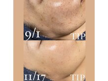 ソランザサロン(Solan the salon)/透明感とハリがでるのが特徴♪