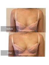 ローズボディ 恵比寿店/バストアップ＆マシュマロバスト