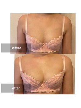 ローズボディ 恵比寿店/バストアップ&マシュマロバスト