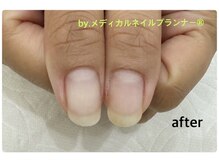 ネイルアロマ(Nail AROMA)の雰囲気（経験豊富な、専門知識を持った施術者にお任せください。）