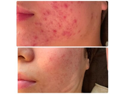 ビーアンドアイ シズオカテン レディース(B&I SHIZUOKA)の写真