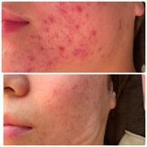 ビーアンドアイ シズオカテン レディース(B&I SHIZUOKA)