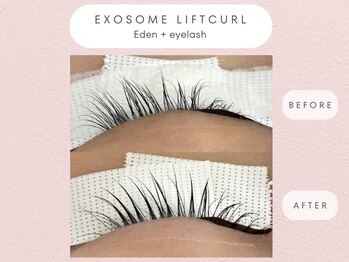 エデン 仙台広瀬通(Eden)/【エクソソーム リフトカール】