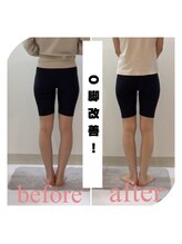 スタイルラボ高松/O脚矯正の効果♪