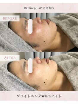 ブリリオプラス 四条烏丸店(Brillio plus)/ブライトニング★IPLフォト