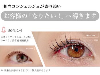 ルナクレスタ 西葛西STATION(Luna Cresta)/コスメリフトフルコース