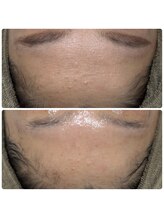 サラン(SALON)/お顔　ビフォーアフター