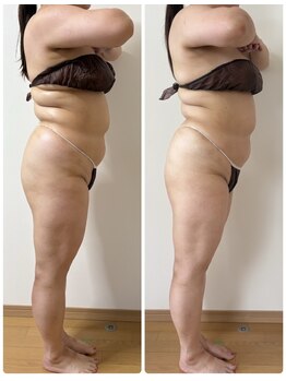 プラム(plum)/セルゼロ2