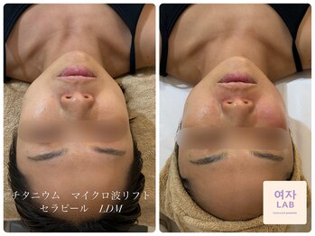 ヨジャラボ(ヨジャLAB)/ビフォーアフター