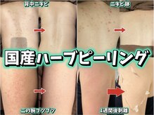 ジュエリーボディー(Jewelry body)