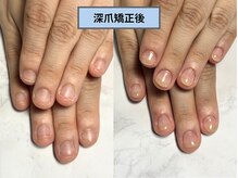 アリエ(allie)/何も気にせず手を繋ぎたい♪