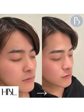 ロミエール 守山店(LOMIERE)/HBL