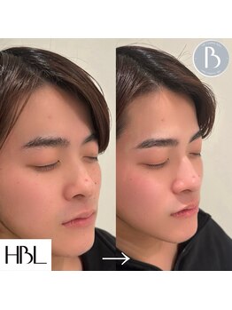 ロミエール 守山店(LOMIERE)/HBL