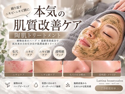 ラティーナ(Lattina)の写真