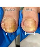 新宿巻き爪補正店/