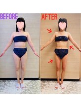 エステティックサロン アール 大阪梅田(esthetic salon R)/50代女性　前