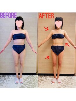 エステティックサロン アール 大阪梅田(esthetic salon R)/50代女性　前