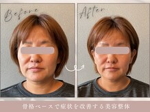 ほぐし屋 かすがい/小顔リフト矯正＋美姿勢整体