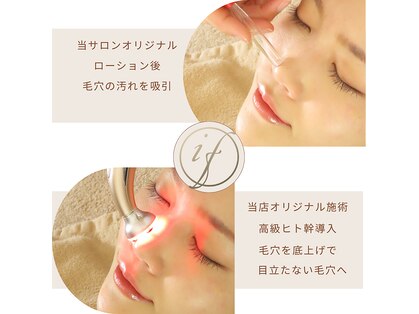 インファイン ハミルトン店(infine)の写真