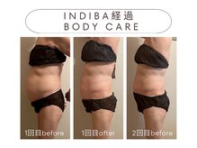 パリワール(pariwar)/インディバ＊ビフォーアフター