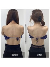 ダリア(Dahlia)/ブライダルエステ