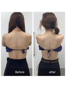 ダリア(Dahlia)/ブライダルエステ