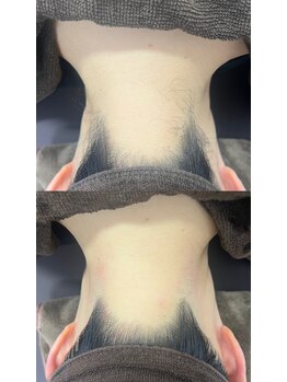 ミース 仙台長町店/うなじ矯正体験1回目!