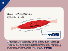 ラシュシュ/サボリ筋とは？