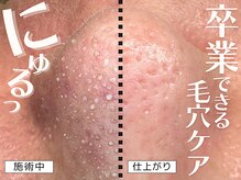 ヴァーチュ(Virtue)