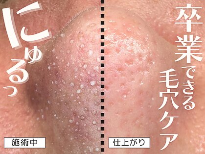 ヴァーチュ(Virtue)の写真