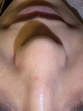 モンド 駒込店(monde)/ハイドラ＋ララピール