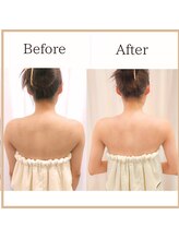 サロンルーチェ(Salon Luce)/ビフォーアフター/施術回数6回