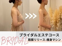 痩身&ブライダルエステサロン MillS 小倉店【3/2 NEW OPEN（予定）】/ブライダルエステコース
