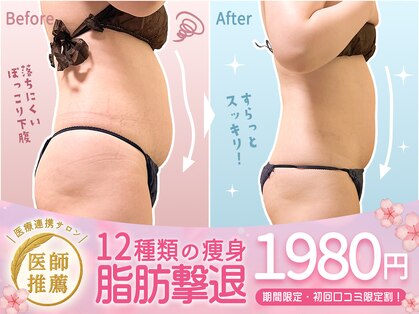 ハノハノ 八代店(HANO HANO)の写真