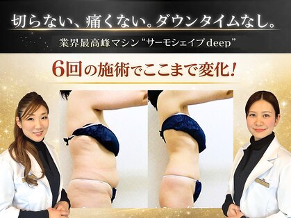 セレブリボーン 大阪ボーテの写真