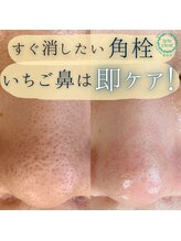サロン リュンヌ(salon lune)/毛穴エクストラクション