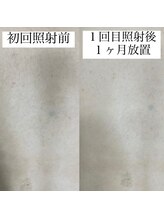 テンパ ビューティー(+10%beauty)/効果写真