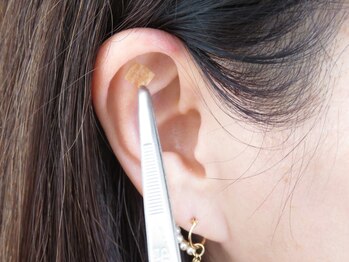 チェレステ(Celeste)/耳つぼ施術