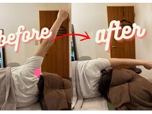 マーレ(MARE)/たった10秒で