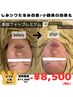 【たるみ改善・毛穴・透明感】美肌フォト×美容液導入¥11,000→¥8,500